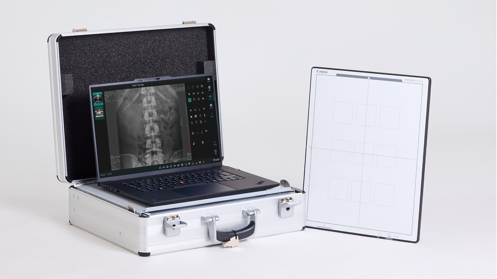X線装置システム「AtomscopeX」